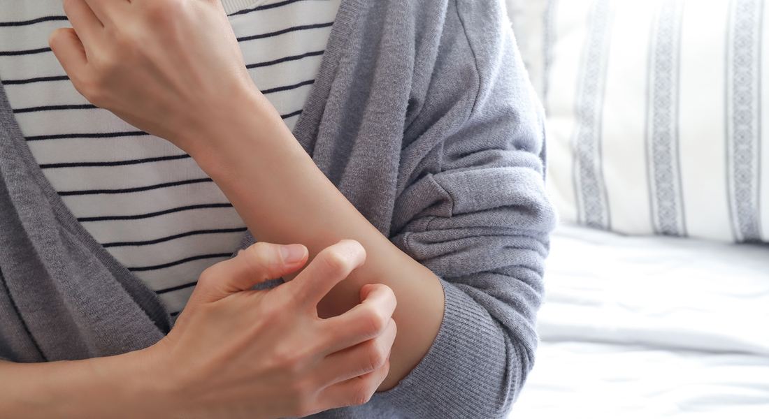 美容鍼でアトピーは改善できる？かゆみ・肌荒れの原因と対策をわかりやすく解説｜越前市周辺の美容鍼ならbeauty hari salon lilli