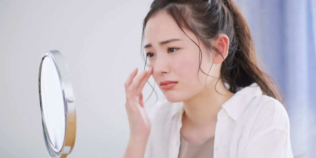 年齢による悩み、目尻のシワを美容鍼で改善！